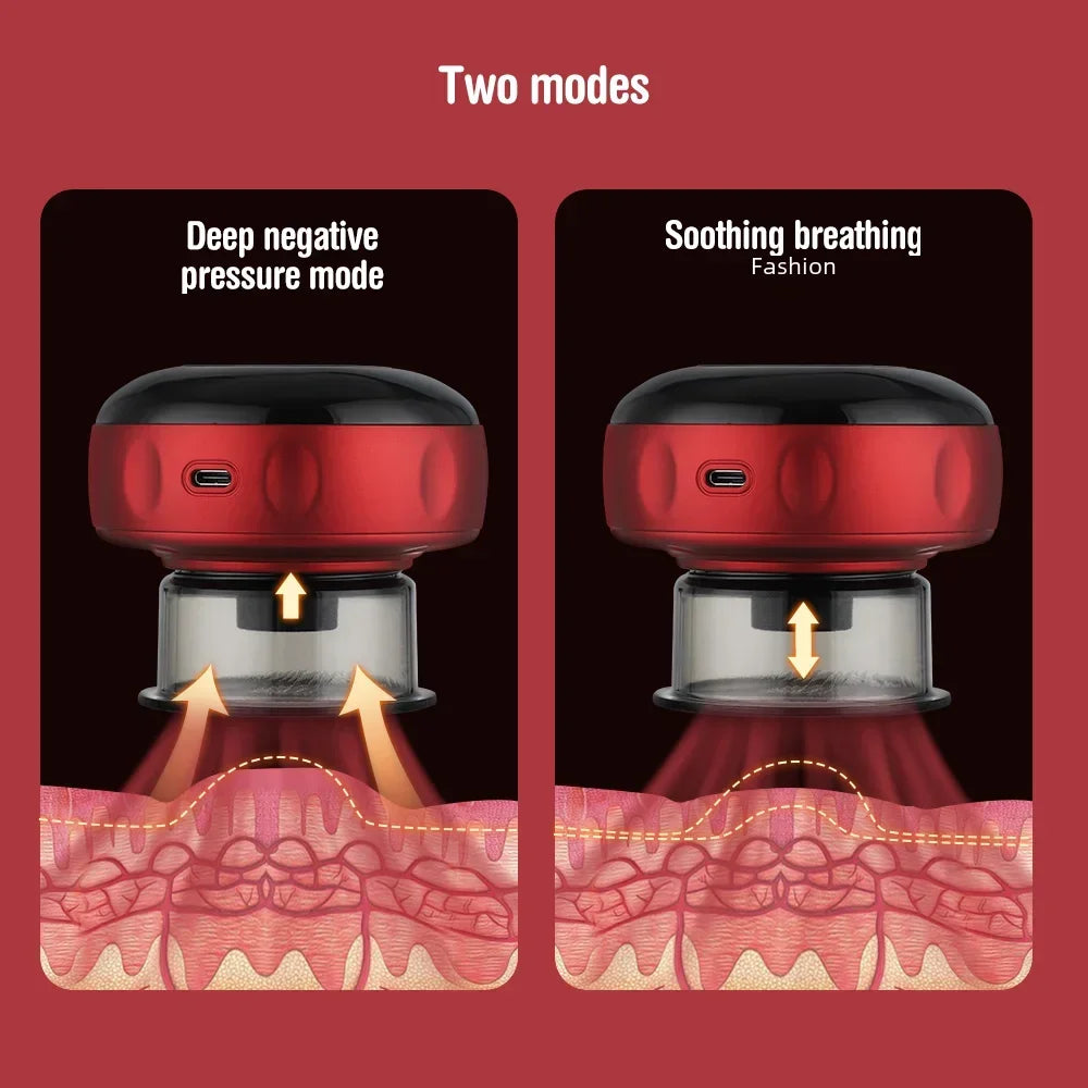Electric Cupping Massager with Heat – Portable Smart Suction Therapy Device for Muscle Relaxation
