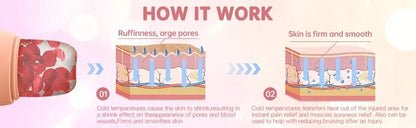 Ice Face Roller to Shrink Pores
